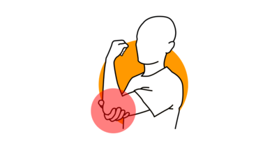 Tendinitis